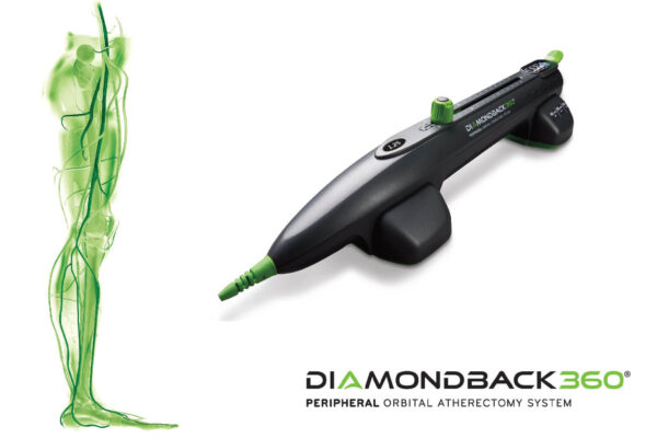 Promotional image of the Diamondback360 Peripheral Orbital Atherectomy System