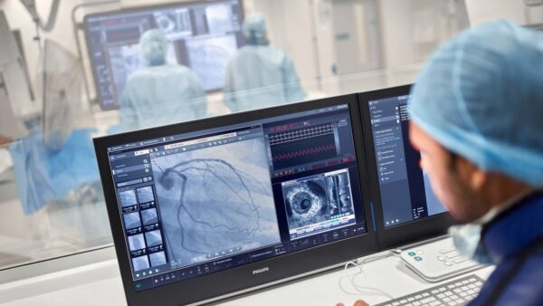 A doctor studies a monitor displaying several images of a heart scan