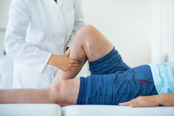 A healthcare professional at the Cardiovascular Institute of the South examining a patient's leg with visible varicose veins.