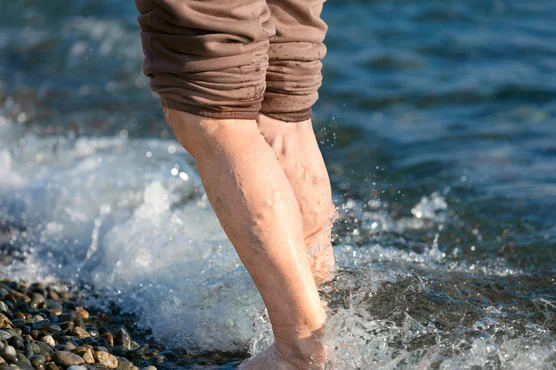 Walking through the gentle waves: a moment of serenity and heart health by the seaside.